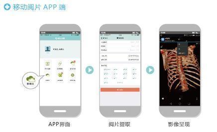 移動(dòng)閱片 2.jpg
